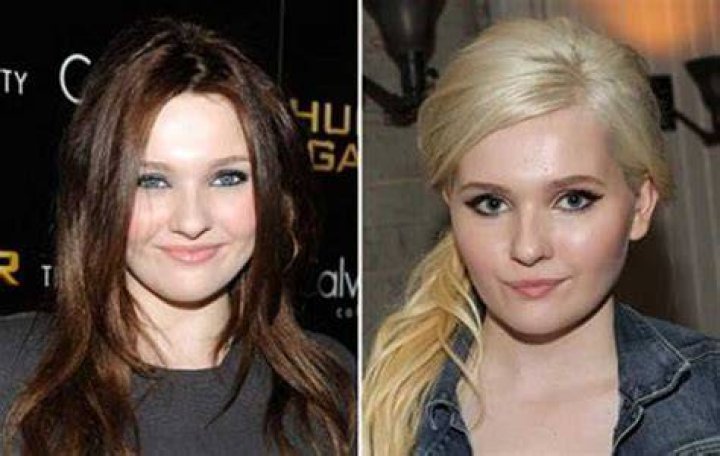 Abigail Breslin Plastic Surgery Before And After: Did She Get Nose Job Done?