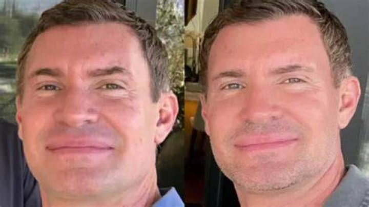 Did Jeff Lewis Undergo Facelift Plastic Surgery Or Not? Family Explored