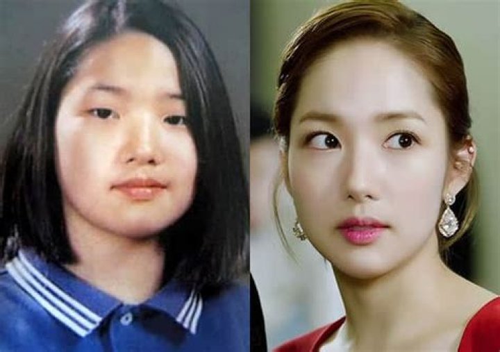 Did Park Min Young Have Plastic Surgery? Park Min Young Before and After