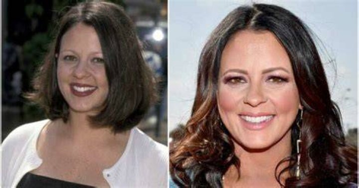 Did Sara Evans Undergo Plastic Surgery On Her Face?