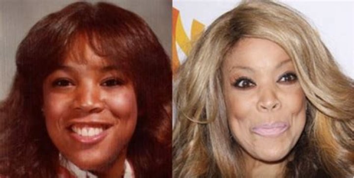 Did Wendy Williams Undergo Plastic Surgery On Her Nose?
