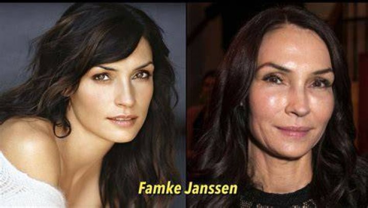 Famke Janssen Plastic Surgery: Now and Then Photos