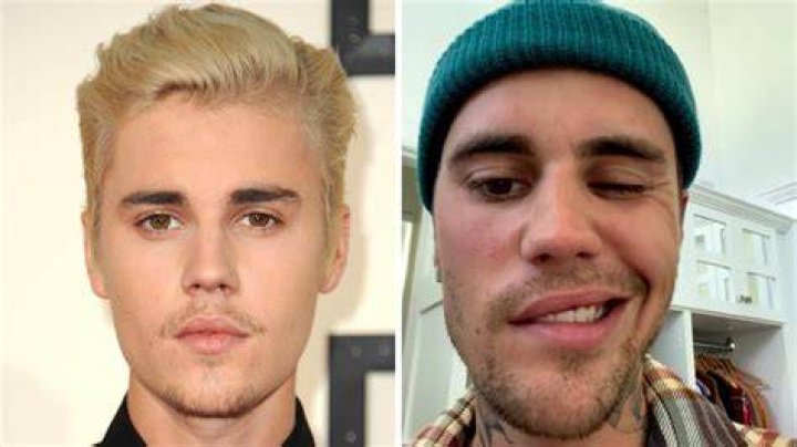 Justin Bieber delays Australian tour to 2023 after health struggle PerthNow