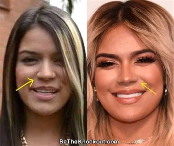 Karol G Before And After, Karol G Plastic Surgery Before And After, Age, Height, And Net Worth