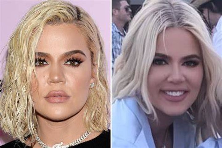 Khloe Kardashian Denies Plastic Surgery Beyond Nose Job