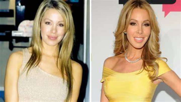 Lisa Hochstein Before And After, Lisa Hochstein Plastic Surgery, Net Worth And Age