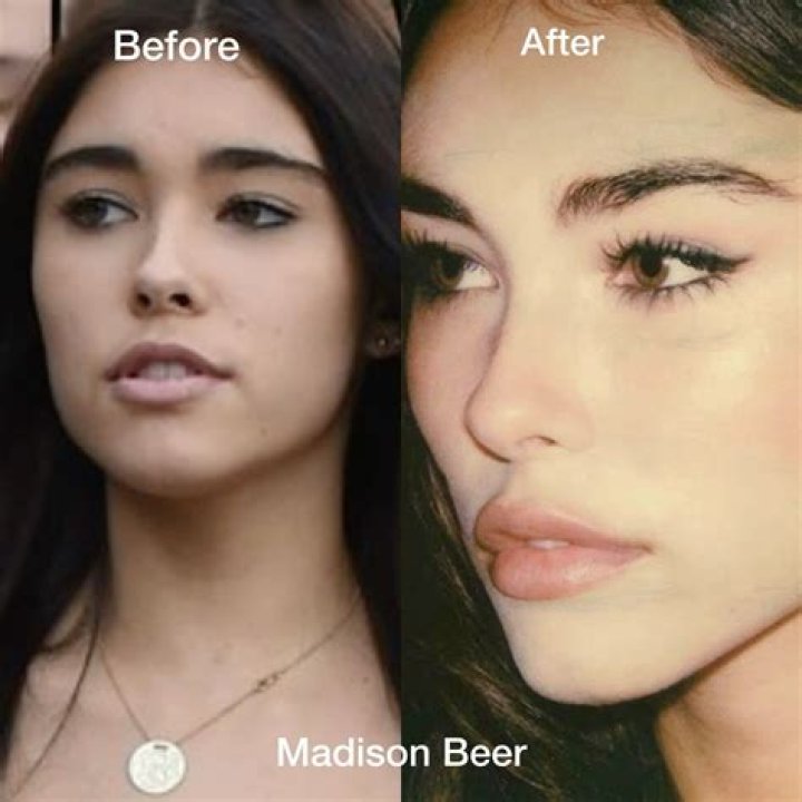 Madison Beer Holds No 'Shame' Over Her Nude Video Leaking at 15, Slams Those Accountable