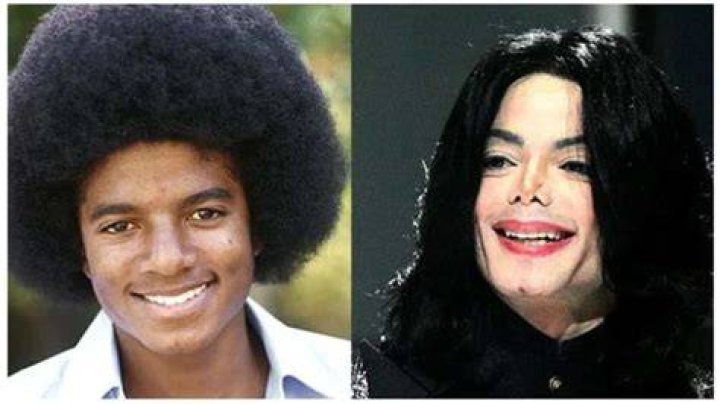 Michael Jackson Plastic Surgery Gone Wrong - Before and After