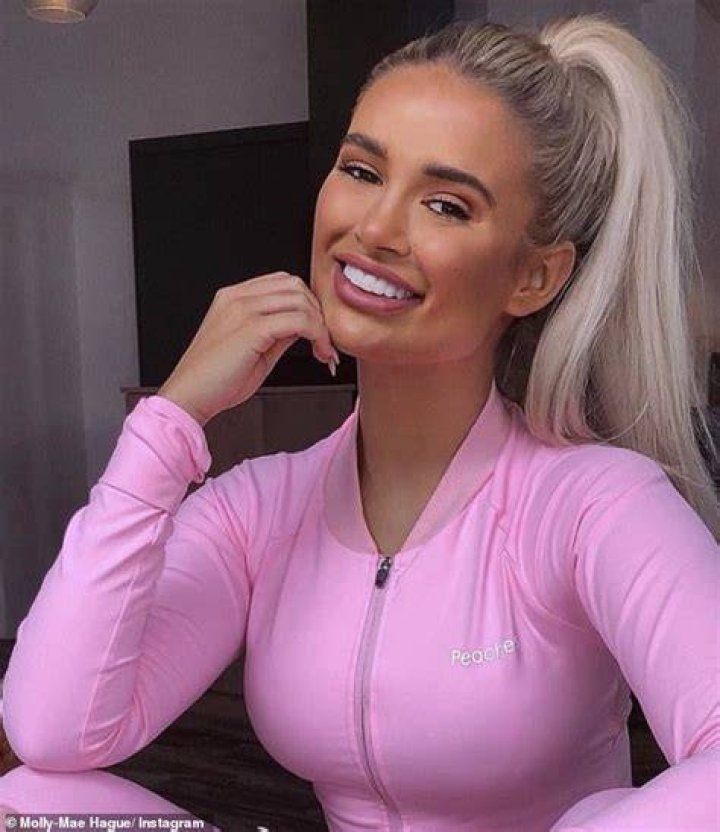 Molly-Mae Hague unveils her teeth transformation after reversing her dental work