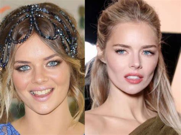 Samara Weaving Weight Loss: Before And After Pictures