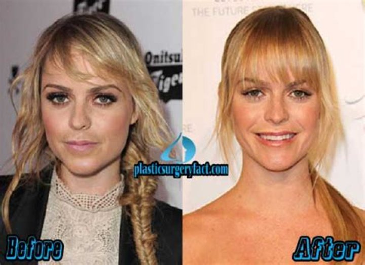 Taryn Manning Plastic Surgery, Taryn Manning Before and After
