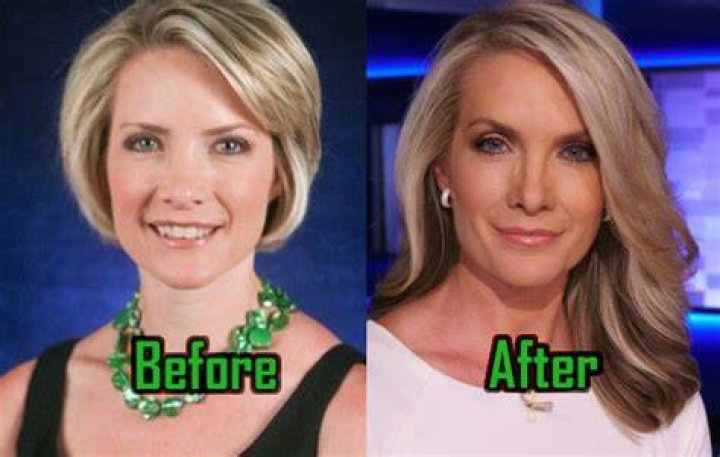 The Stunning Transformation Of Dana Perino