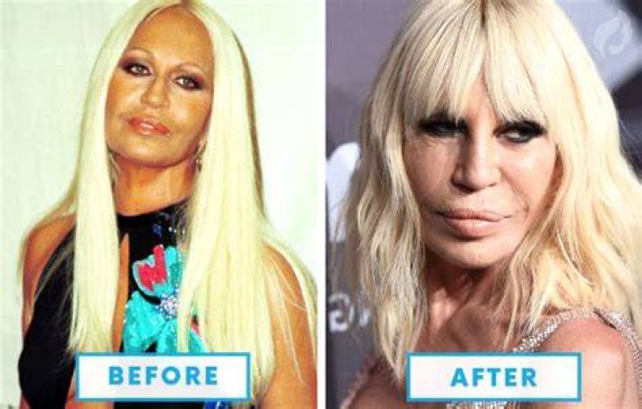 Top 9 Terribly Failed Celebrity Plastic Surgeries