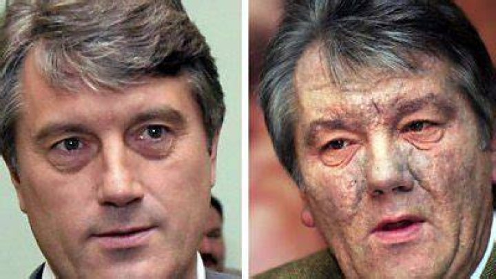 Viktor Yushchenko Face Before And After, Former President Was Poisoned By An Agent